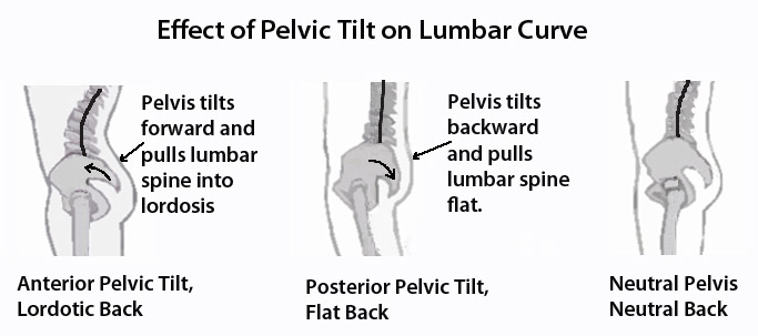 effect of pelvic tilt on lumbar curve